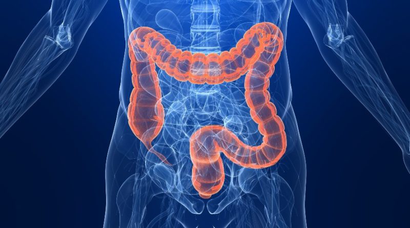Colon cancer deaths rise among younger adults